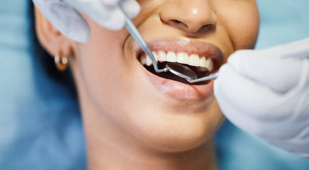 Best Mobile Emergency Dentist in Rancho Cordova, CA
