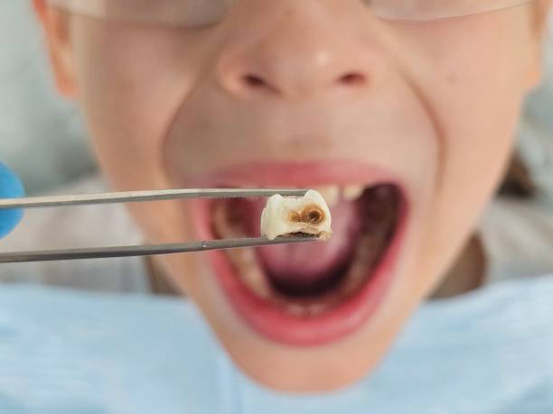 Best Emergency Cosmetic Dentistry in Rancho Cordova, CA