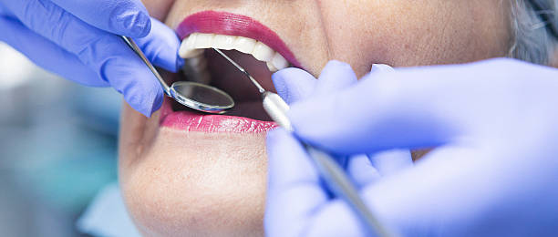 Best Weekend Emergency Dentist in Rancho Cordova, CA